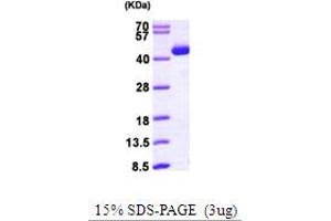SDS-PAGE (SDS) image for Acetyl-CoA Acetyltransferase 2 (ACAT2) (AA 1-397) protein (His tag) (ABIN667155) (ACAT2 Protein (AA 1-397) (His tag))