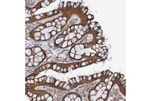 Immunohistochemical staining of human colon with ST8SIA6 polyclonal antibody  shows strong cytoplasmic positivity in glandular cells at 1:50-1:200 dilution.