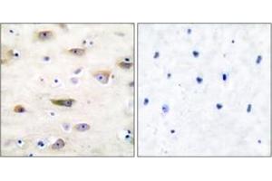 Immunohistochemistry analysis of paraffin-embedded human brain tissue, using GluR2 (Ab-880) Antibody.