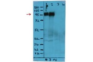 Western Blot analysis using CD107a / LAMP1 Antibody Cat. (LAMP1 antibody)