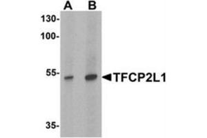 Western blot analysis of TFCP2L1 in human colon tissue lysate with TFCP2L1 antibody at (A) 1 and (B) 2 ug/mL (TFCP2L1 antibody  (N-Term))
