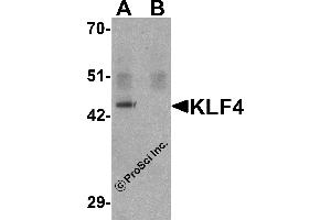 Western Blotting (WB) image for anti-Kruppel-Like Factor 4 (Gut) (KLF4) antibody (ABIN1031709) (KLF4 antibody)