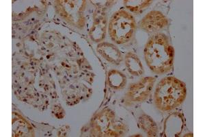 IHC image of ABIN7127810 diluted at 1:100 and staining in paraffin-embedded human kidney tissue performed on a Leica BondTM system.