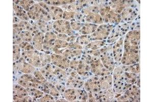 Immunohistochemical staining of paraffin-embedded liver tissue using anti-SRR mouse monoclonal antibody. (SRR antibody)
