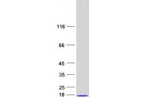 C-Myc Binding Protein (MYCBP) protein (Myc-DYKDDDDK Tag)