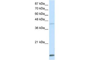 WB Suggested Anti-MKX Antibody Titration:  0. (MKX antibody  (Middle Region))