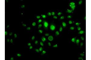 Immunofluorescence analysis of U20S cell using HOXB7 antibody. (HOXB7 antibody)