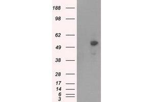 Western Blotting (WB) image for anti-Protein Kinase, CAMP-Dependent, Regulatory, Type II, alpha (PRKAR2A) antibody (ABIN1500256) (PRKAR2A antibody)