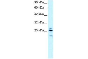 Human brain; WB Suggested Anti-RGS20 Antibody Titration: 2. (RGS20 antibody  (all Isoforms, Middle Region))