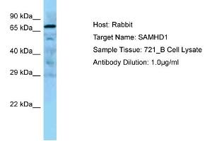 WB Suggested Anti-SAMHD1 Antibody Titration: 0. (SAMHD1 antibody  (Middle Region))