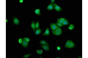 Immunofluorescence staining of HepG2 cells with ABIN7143477 at 1:100, counter-stained with DAPI. (ARL11 antibody  (AA 2-196))