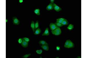 Immunofluorescence staining of HepG2 cells with ABIN7143477 at 1:100, counter-stained with DAPI. (ARL11 antibody  (AA 2-196))