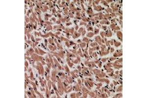 Immunohistochemical analysis of MYCBP staining in human heart formalin fixed paraffin embedded tissue section. (MYCBP antibody)