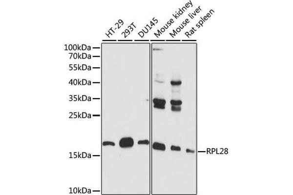 RPL28 anticorps  (AA 1-100)