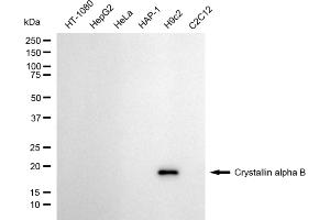 Western blotting analysis using crystallin alpha B antibody (ABIN7798168).