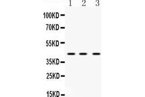 Western blot analysis of HnRNP F expression in rat liver extract ( Lane 1), mouse spleen extract ( Lane 2) and HELA whole cell lysates ( Lane 3). (HNRNPF antibody  (N-Term))