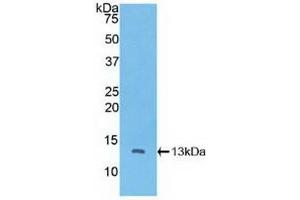 Detection of Recombinant CTNNbIP1, Human using Polyclonal Antibody to Catenin Beta Interacting Protein 1 (CTNNbIP1) (CTNNBIP1 antibody  (AA 1-81))