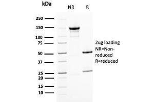 SDS-PAGE (SDS) image for anti-BMI1 Polycomb Ring Finger Oncogene (BMI1) (AA 142-326) antibody (ABIN6940582)