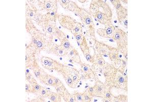 Immunohistochemistry of paraffin-embedded human liver injury using PSMF1 antibody at dilution of 1:100 (x40 lens).