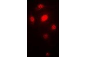 Immunofluorescent analysis of ORC6 staining in SW620 cells. (ORC6 antibody)
