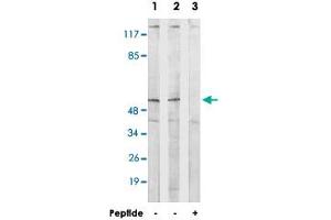 Western blot analysis of extracts from HepG2 cells (Lane 1 and lane 3) and COS cells (Lane 2), using ALDH1B1 polyclonal antibody . (ALDH1B1 antibody)