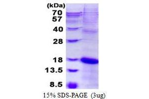 Image no. 1 for Killer Cell Lectin-Like Receptor Subfamily C, Member 2 (KLRC2) (full length) protein (His tag) (ABIN1098669)