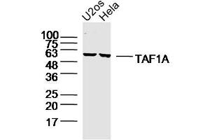 Lane 1: u2os lysates Lane 2: hela lysates probed with TAF1A Polyclonal Antibody, Unconjugated  at 1:300 dilution and 4˚C overnight incubation. (TAF1A antibody  (AA 21-120))
