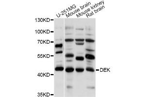Western blot analysis of extracts of various cell lines, using DEK antibody (ABIN5995944) at 1/1000 dilution. (DEK antibody)