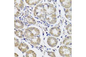 Immunohistochemistry of paraffin-embedded human stomach using CTSC antibody at dilution of 1:100 (x40 lens). (CTSC antibody)