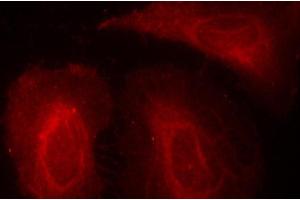 Immunofluorescence staining of methanol-fixed Hela cells, using Phospho-PDPK1-S241 antibody. (PDPK1 antibody  (pSer241))