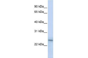 WB Suggested Anti-PSMB9 Antibody Titration:  0. (PSMB9 antibody  (C-Term))