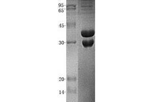 Validation with Western Blot (UBE2J2 Protein (Transcript Variant 2) (His tag))