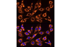 Immunofluorescence analysis of NIH/3T3 cells using  Rabbit pAb (ABIN6129864, ABIN6136458, ABIN6136459 and ABIN6222564) at dilution of 1:100 (40x lens). (ACSL4 antibody  (AA 1-280))