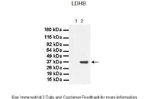 Western Blotting (WB) image for anti-Lactate Dehydrogenase B (LDHB) (C-Term) antibody (ABIN2783283)