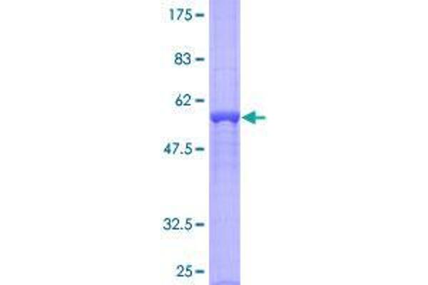 ASB13 Protein (GST tag)