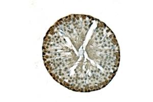 IHC analysis of LSM8 using anti-LSM8 antibody (ABIN7599579).