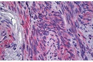 Human Uterus, Myometrium: Formalin-Fixed, Paraffin-Embedded (FFPE) (IFITM1 antibody  (Internal Region))
