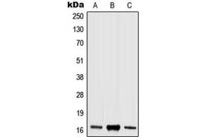 Western blot analysis of Histone H3 (pS10) expression in HEK293T LPS-treated (A), Raw264. (Histone 3 antibody  (pSer10))