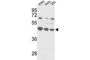 Western blot analysis of SS-B antibody and K562, HeLa, 293 lysate. (SSB antibody  (AA 366-397))