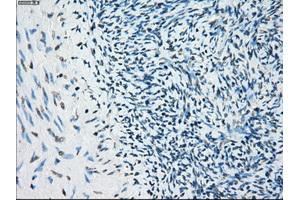 Immunohistochemistry (IHC) image for anti-Budding Uninhibited By Benzimidazoles 1 Homolog beta (Yeast) (BUB1B) antibody (ABIN1496996) (BUB1B antibody)