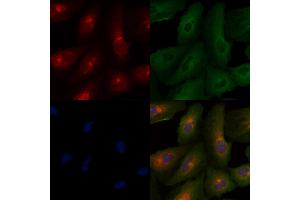 ABIN6261879 and ABIN6277946 staining  cells by IF/ICC. (GAP43 antibody  (C-Term))