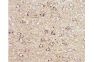 IHC-P: Amyloid beta antibody testing of mouse brain tissue