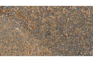 Immunohistochemistry of paraffin-embedded Human tonsil tissue using CPA2 Polyclonal Antibody at dilution 1:40 (Carboxypeptidase A2 antibody)