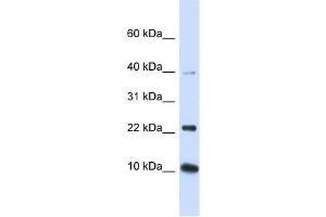 UBE2D2 antibody used at 1 ug/ml to detect target protein. (UBE2D2 antibody)