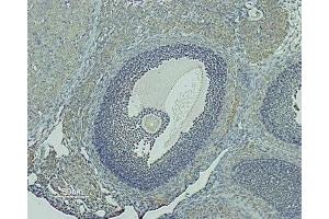 Expression of GnRHR in rat ovary - Immunohistochemical staining of rat ovary paraffin-embedded sections using Anti-GnRH Receptor (extracellular) Antibody (ABIN7043262 and ABIN7044416). (GNRHR antibody  (Extracellular, N-Term))