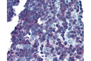 Immunohistochemical staining (Formalin-fixed paraffin-embedded sections) of human thymus with LAT monoclonal antibody, clone LAT1111  at 10 ug/mL working concentration. (LAT antibody  (Cytoplasmic Domain))