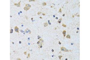Immunohistochemistry of paraffin-embedded Rat brain using PDP1 Polyclonal Antibody at dilution of 1:100 (40x lens). (PDP antibody)