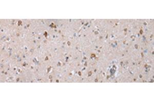 Immunohistochemistry of paraffin-embedded Human brain tissue using COX7C Polyclonal Antibody at dilution of 1:40(x200) (COX7C antibody)