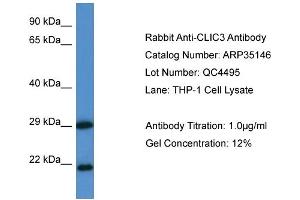 WB Suggested Anti-CLIC3 Antibody   Titration: 1.