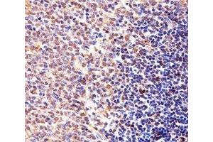 Immunohistochemical analysis of paraffin-embedded mouse spleen section using Cyclin B1 antibody. (Cyclin B1 antibody  (AA 103-130))